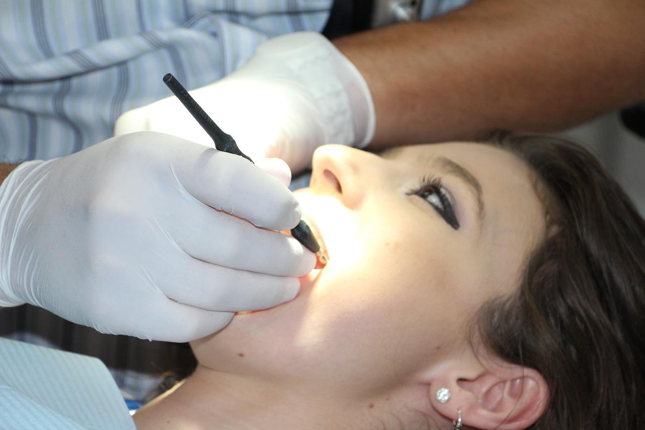 Le blanchiment dentaire américain : une technique très tendance