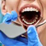 3 choses à savoir avant d’entamer un traitement d’orthodontie